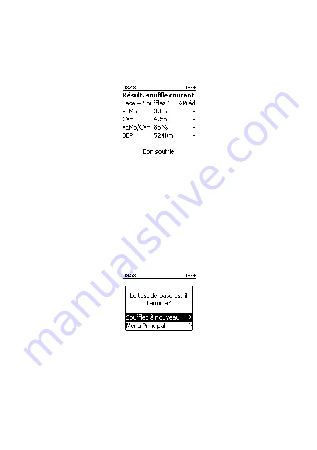 CareFusion Micro I Operating Manual Download Page 83