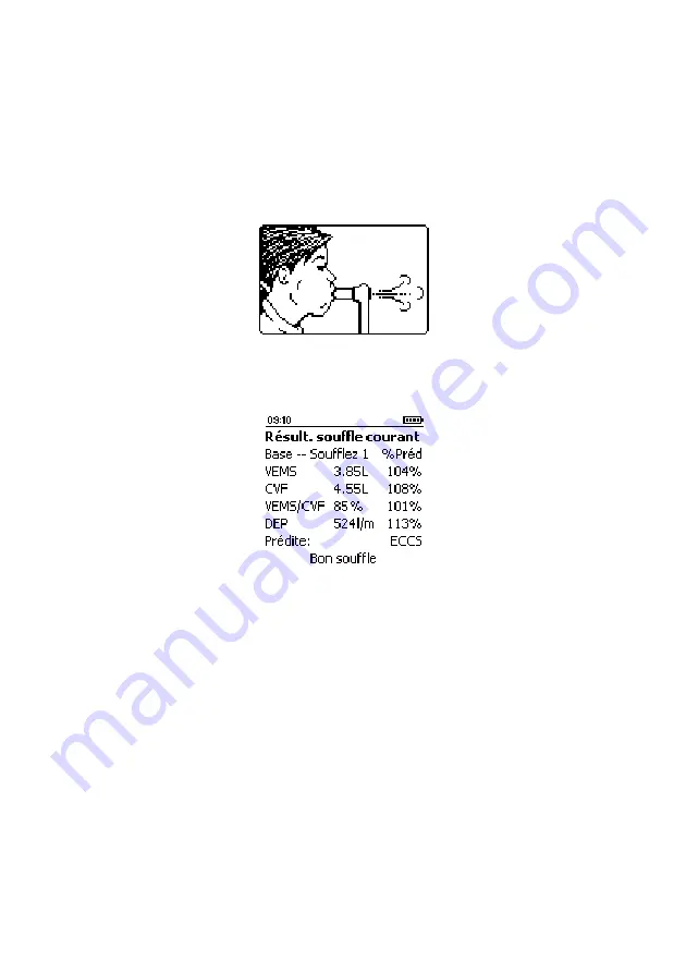 CareFusion Micro I Operating Manual Download Page 85