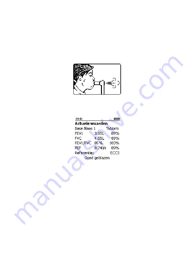 CareFusion Micro I Operating Manual Download Page 205