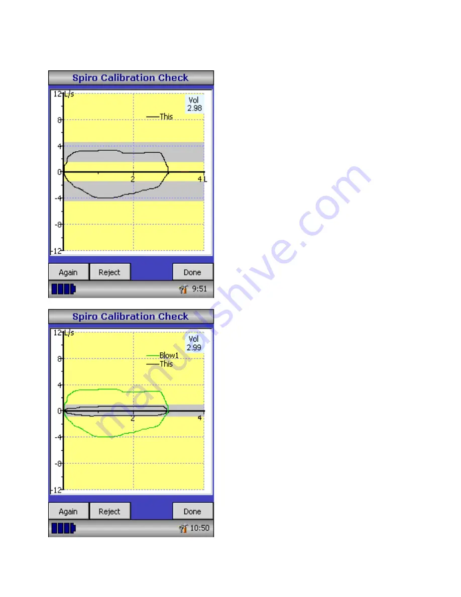 CareFusion MicroLoop Скачать руководство пользователя страница 18