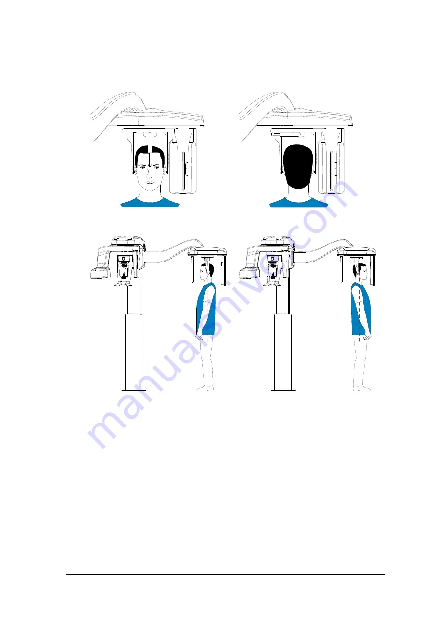 Carestream DENTAL CS 8100 Access Скачать руководство пользователя страница 35