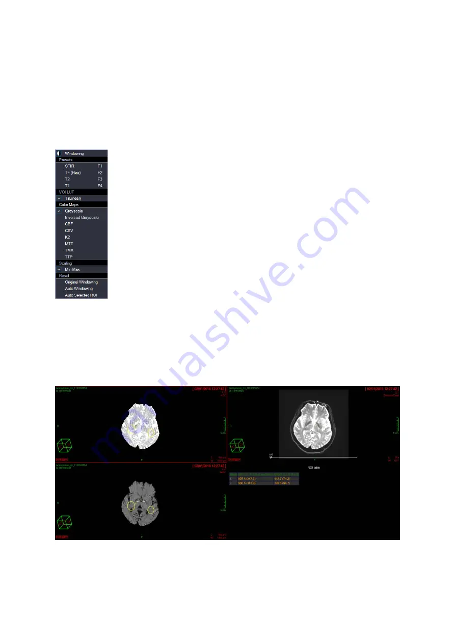 Carestream Vue PACS MR Diffusion Скачать руководство пользователя страница 16