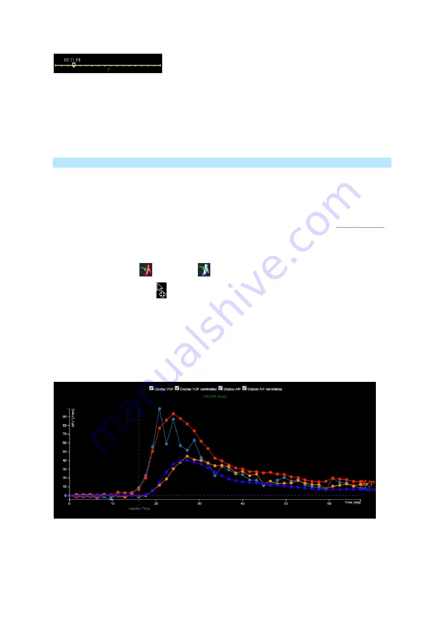 Carestream Vue PACS MR Diffusion User Manual Download Page 25