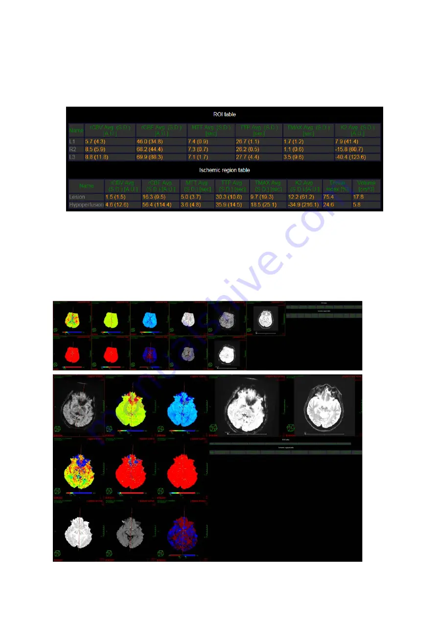 Carestream Vue PACS MR Diffusion User Manual Download Page 30