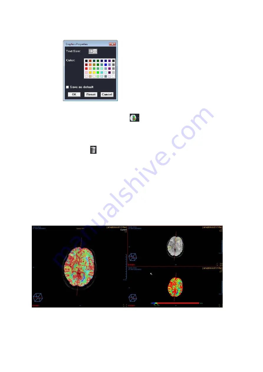 Carestream Vue PACS MR Diffusion User Manual Download Page 32