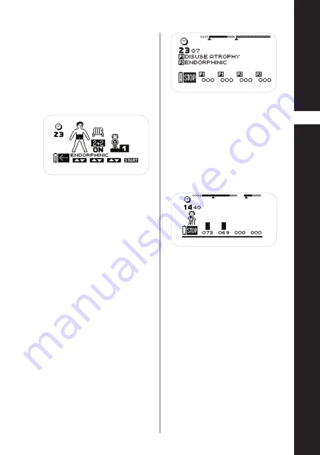 CefarCompex Rehab 400 User Manual Download Page 57