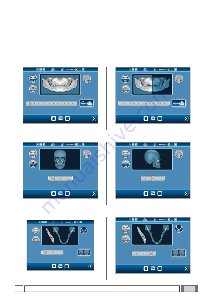 CEFLA NewTom GO Manual Download Page 33