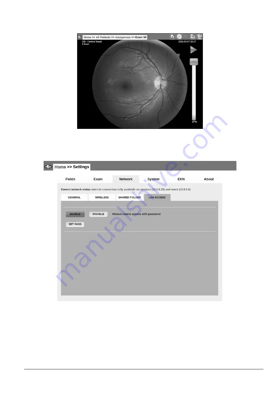 CenterVue drs Скачать руководство пользователя страница 37