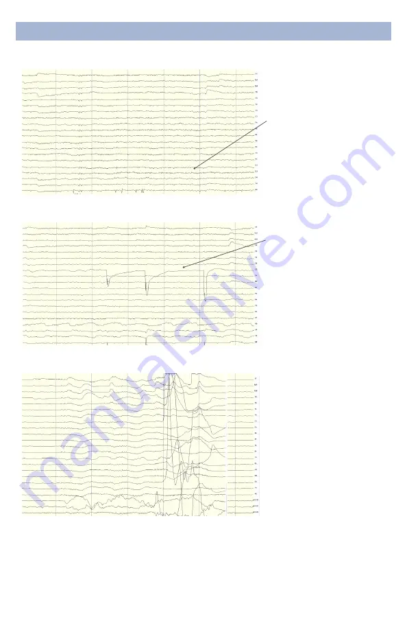 CGX Quick-20r Manual Download Page 17