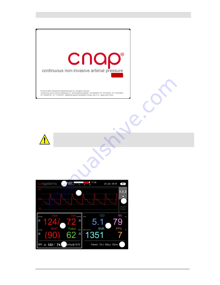 CNSystems CNAP Monitor 500 HD Operator'S Manual Download Page 23