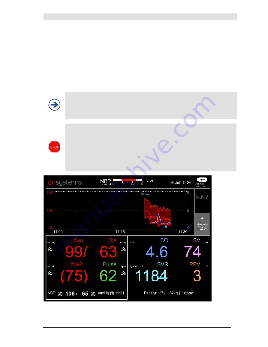 CNSystems CNAP Monitor 500 HD Operator'S Manual Download Page 59