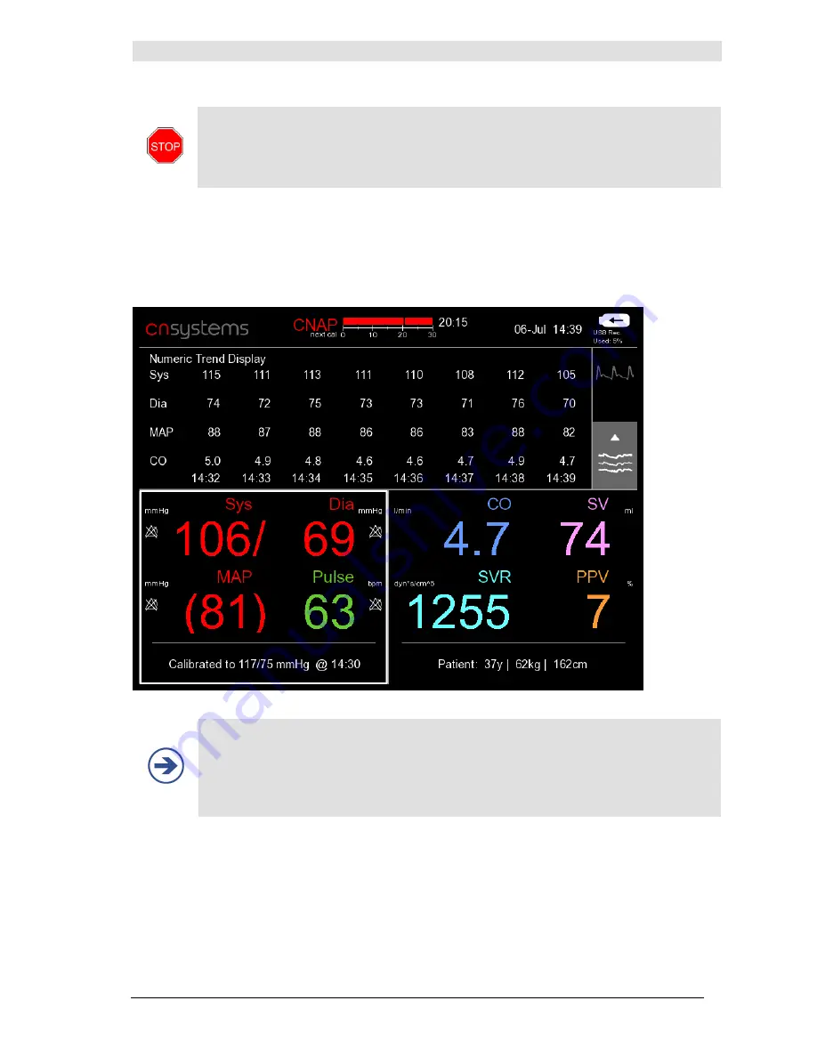 CNSystems CNAP Monitor 500 HD Operator'S Manual Download Page 62