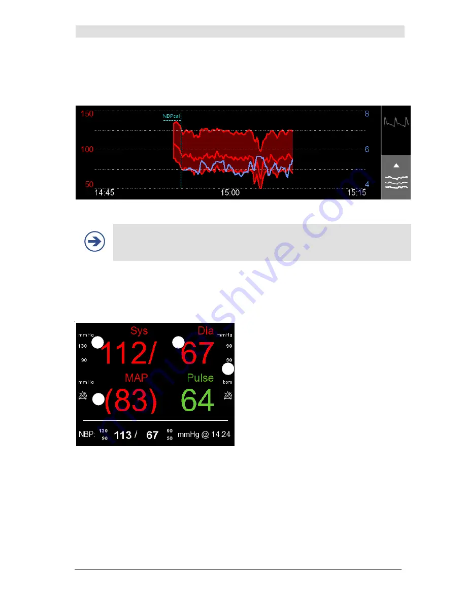 CNSystems CNAP Monitor 500 HD Operator'S Manual Download Page 76