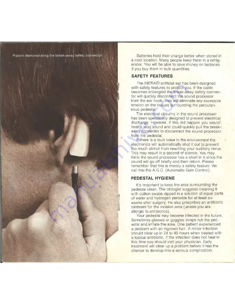 Cochlear INERAID Owner'S Handbook Manual Download Page 6