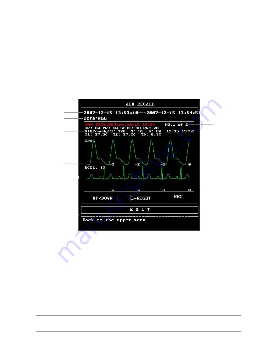 Contec Medical Systems Co. CMS8000 User Manual Download Page 44