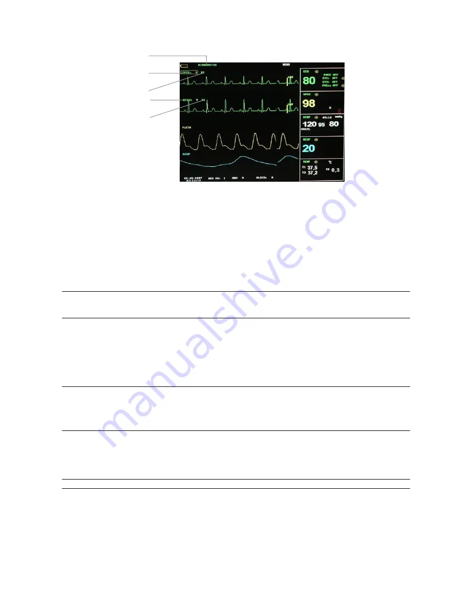 Contec Medical Systems Co. CMS8000 User Manual Download Page 61