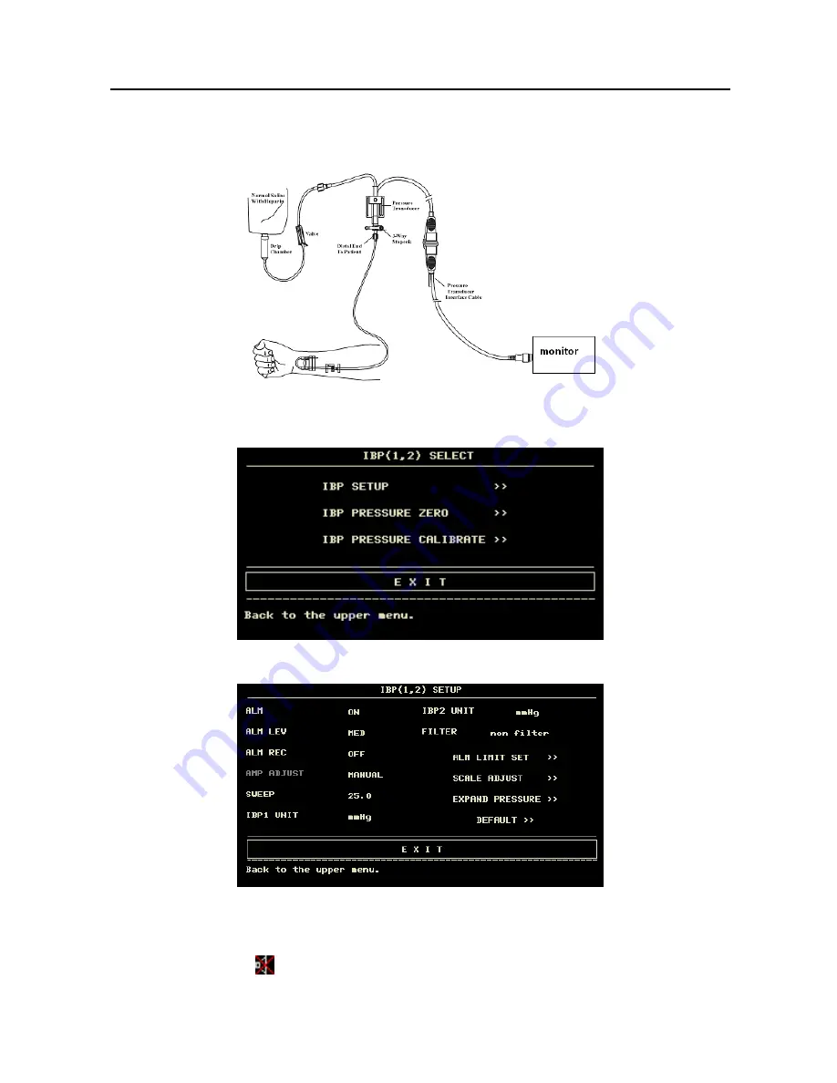 Contec Medical Systems Co. CMS8000 User Manual Download Page 91