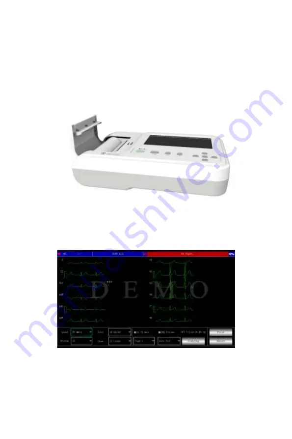 CONTEC MEDICAL SYSTEMS EKG6012 Скачать руководство пользователя страница 21