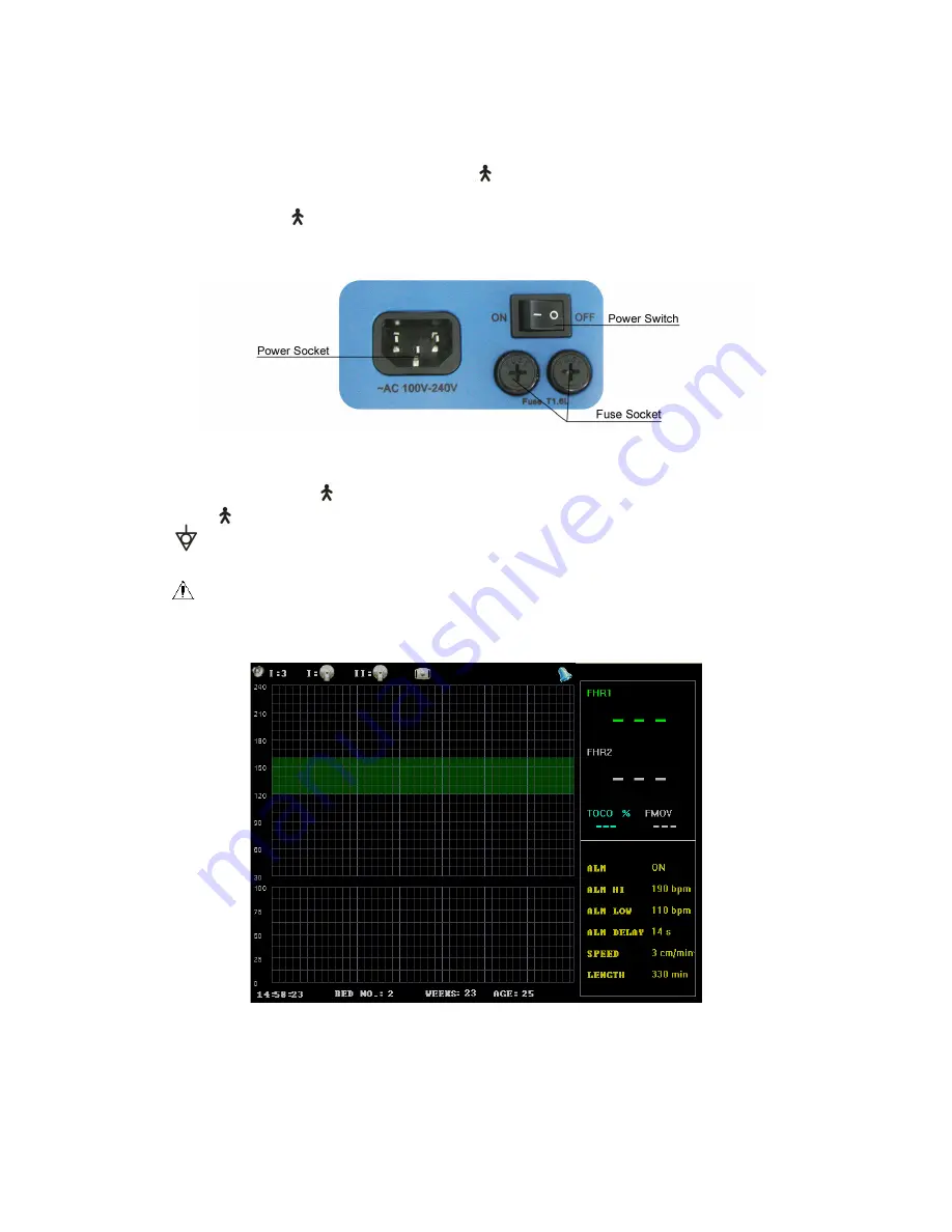 Contec CMS800G User Manual Download Page 9