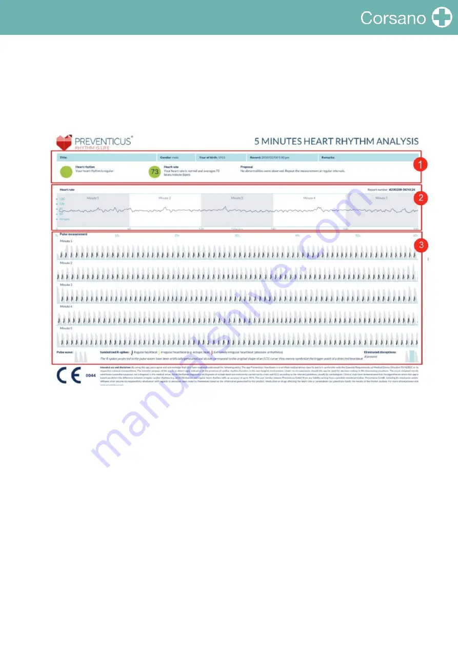 Corsano CardioWatch 287 Instruction Manual Download Page 32