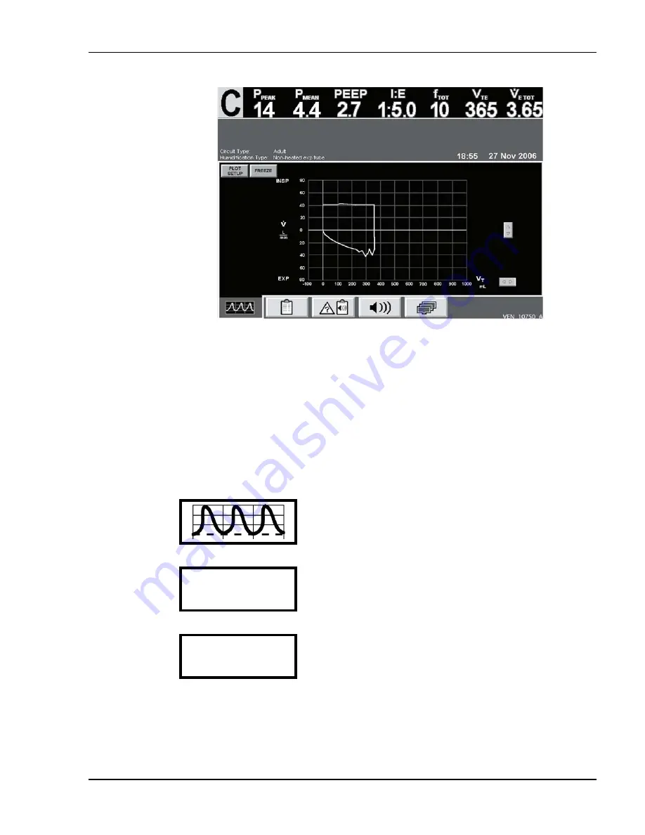 Coviden Puritan Bennett 800 Series Operator And Technical Reference Manual Download Page 159