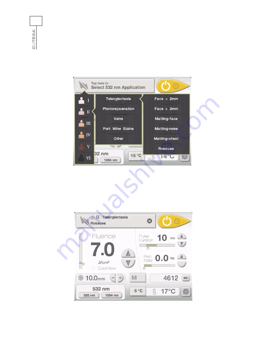 Cutera Excel V+ Скачать руководство пользователя страница 42