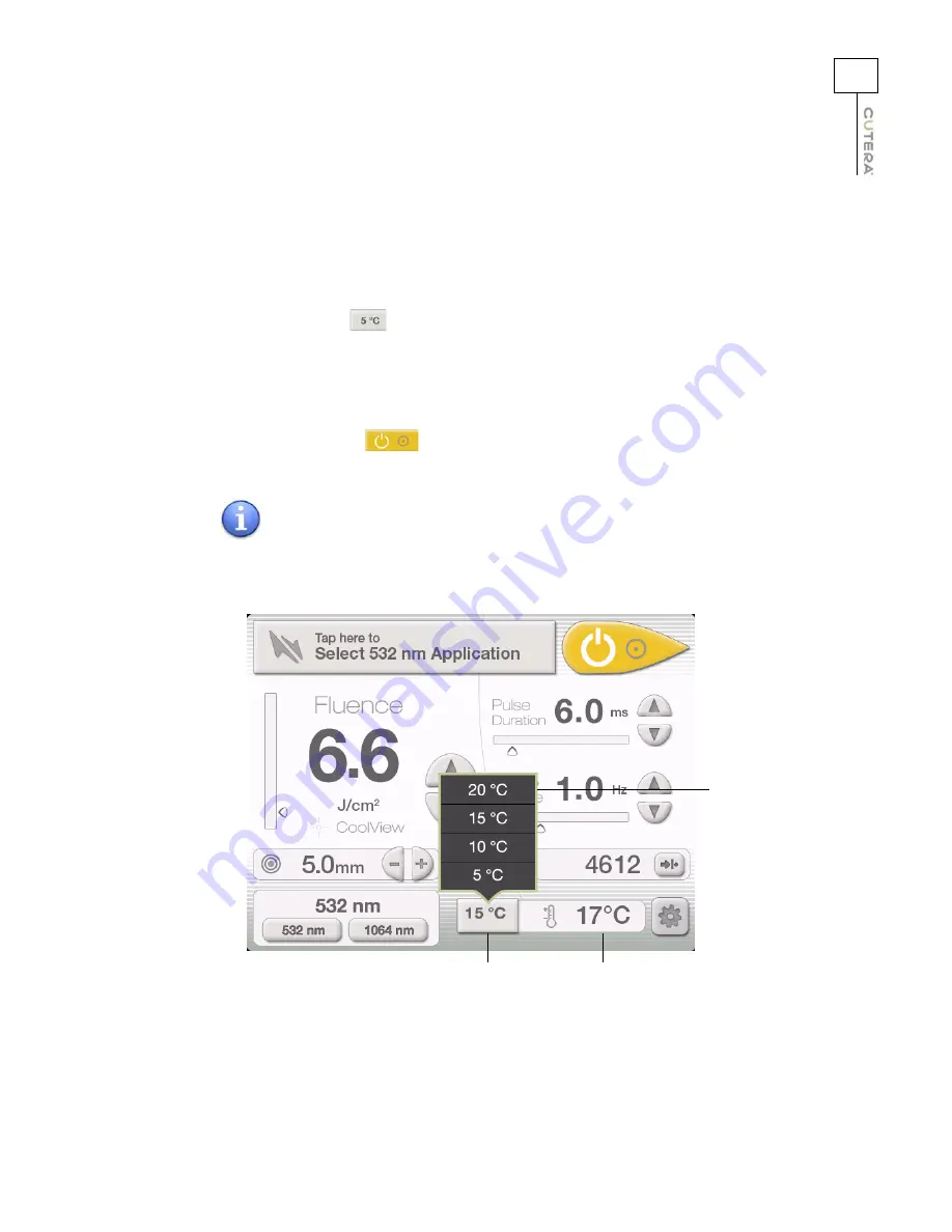 Cutera Excel V+ Operator'S Manual Download Page 53