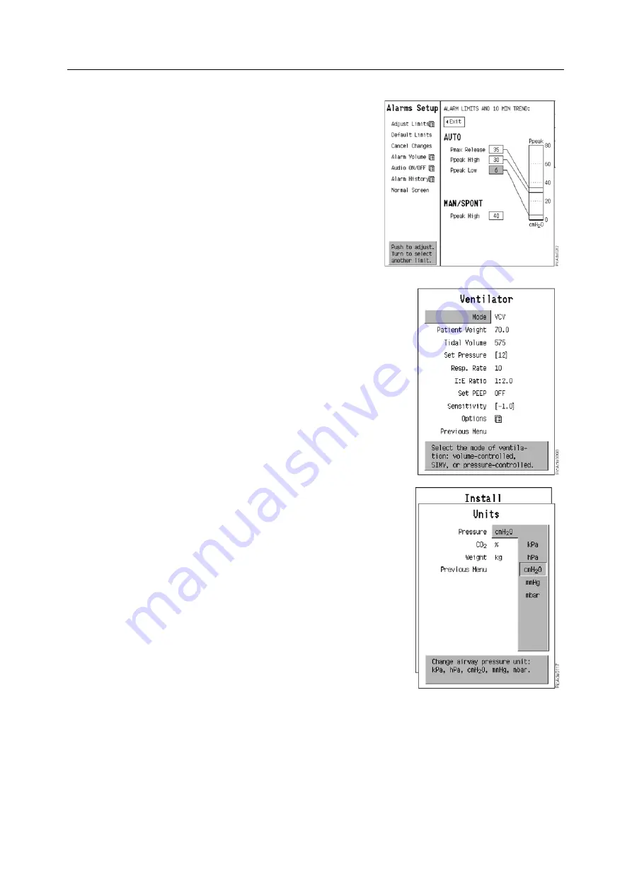 Datex-Ohmeda Anesthesia Delivery Unit S/5 Technical Reference Manual Download Page 49