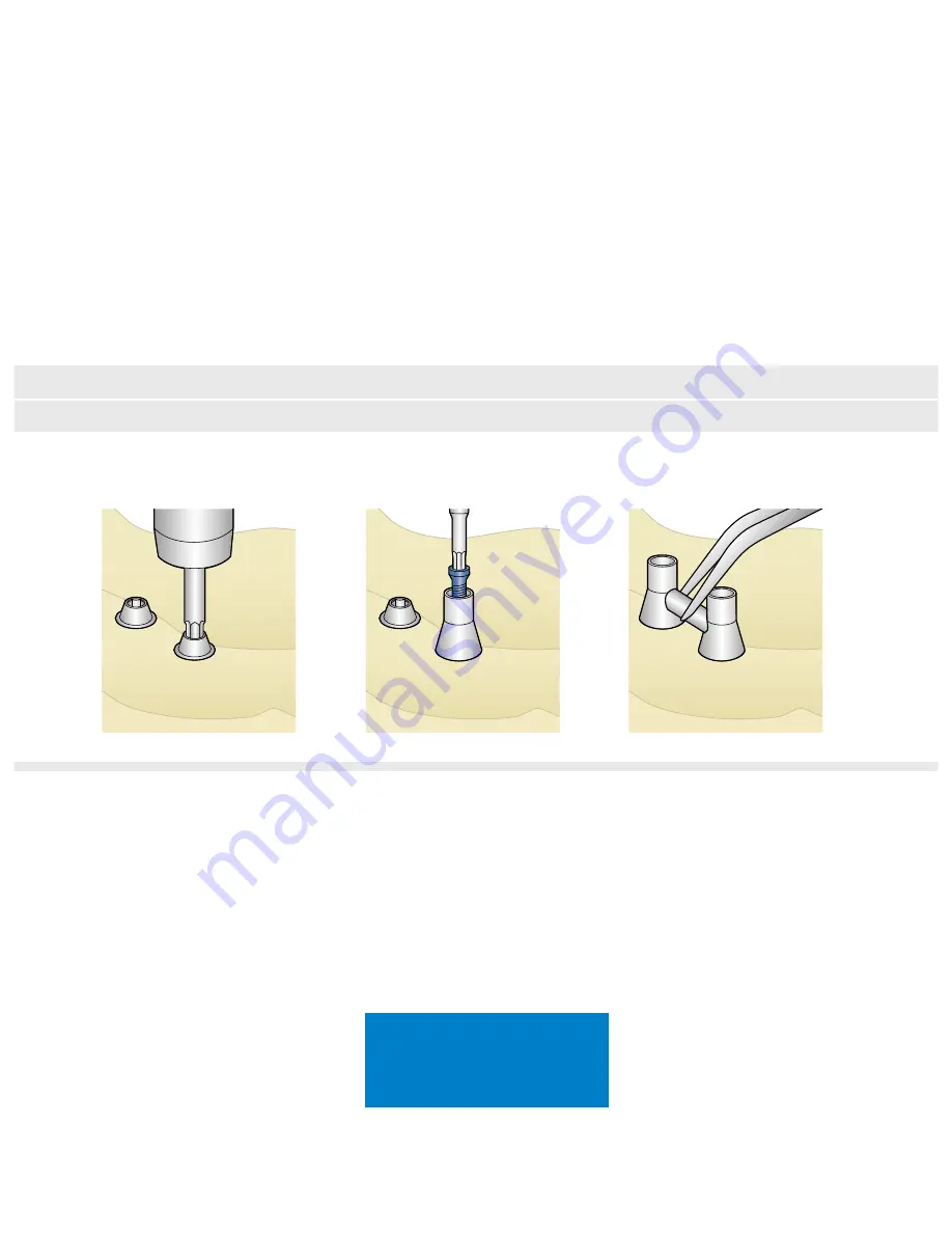 Dentsply Sirona Ankylos Balance Base Abutment C Скачать руководство пользователя страница 48