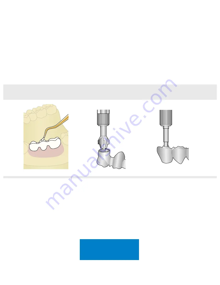 Dentsply Sirona Ankylos Balance Base Abutment C Скачать руководство пользователя страница 56