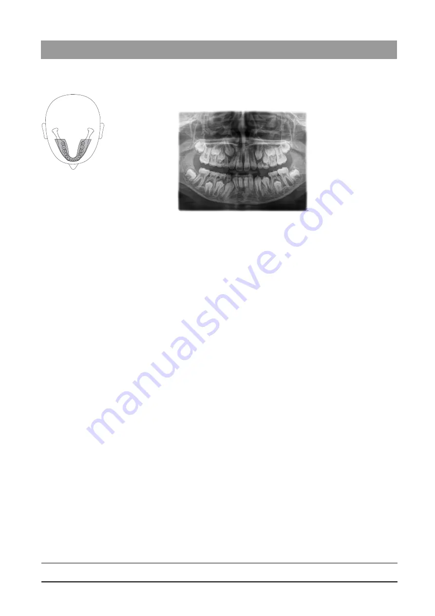 Dentsply Sirona Orthophos SL 2D Operating Instructions Manual Download Page 53