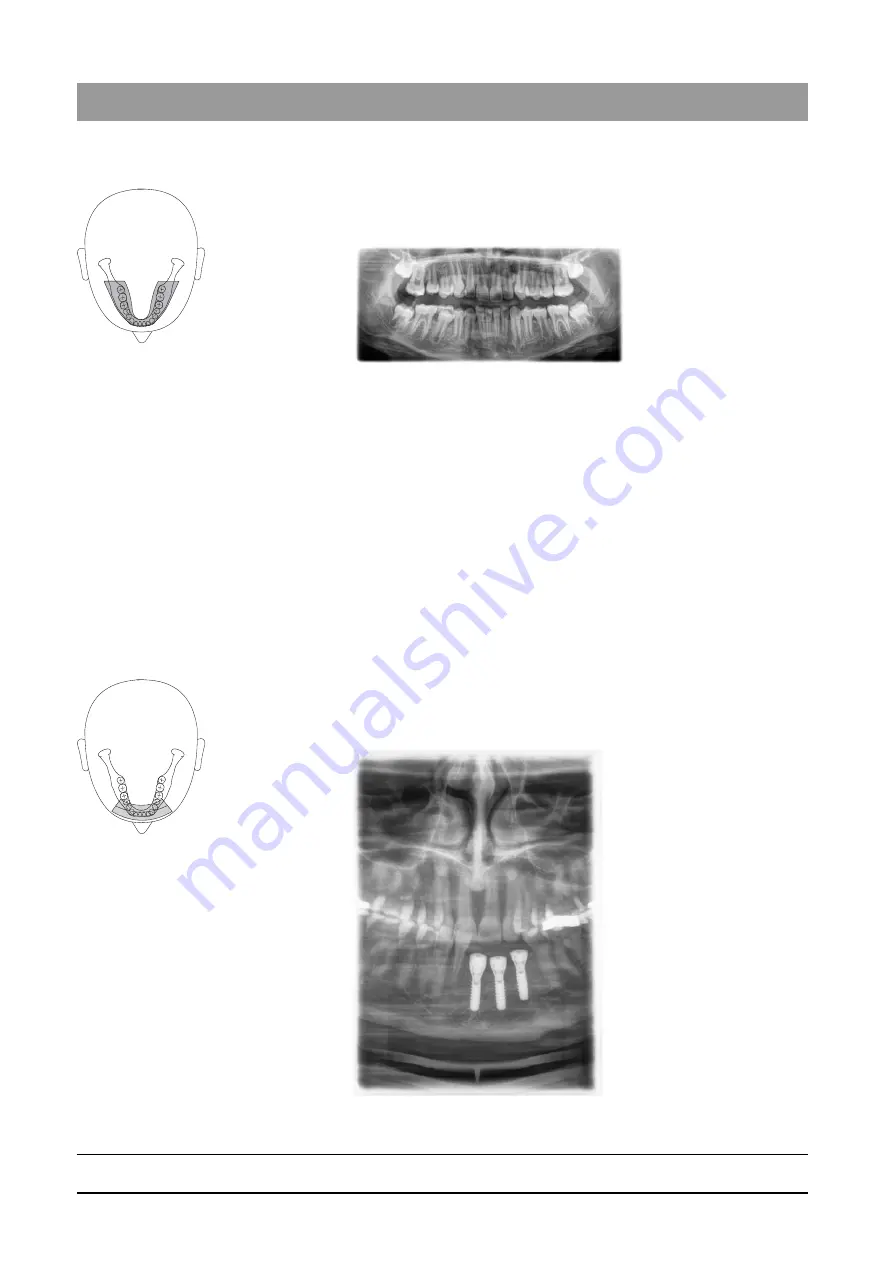 Dentsply Sirona Orthophos SL 2D Скачать руководство пользователя страница 54