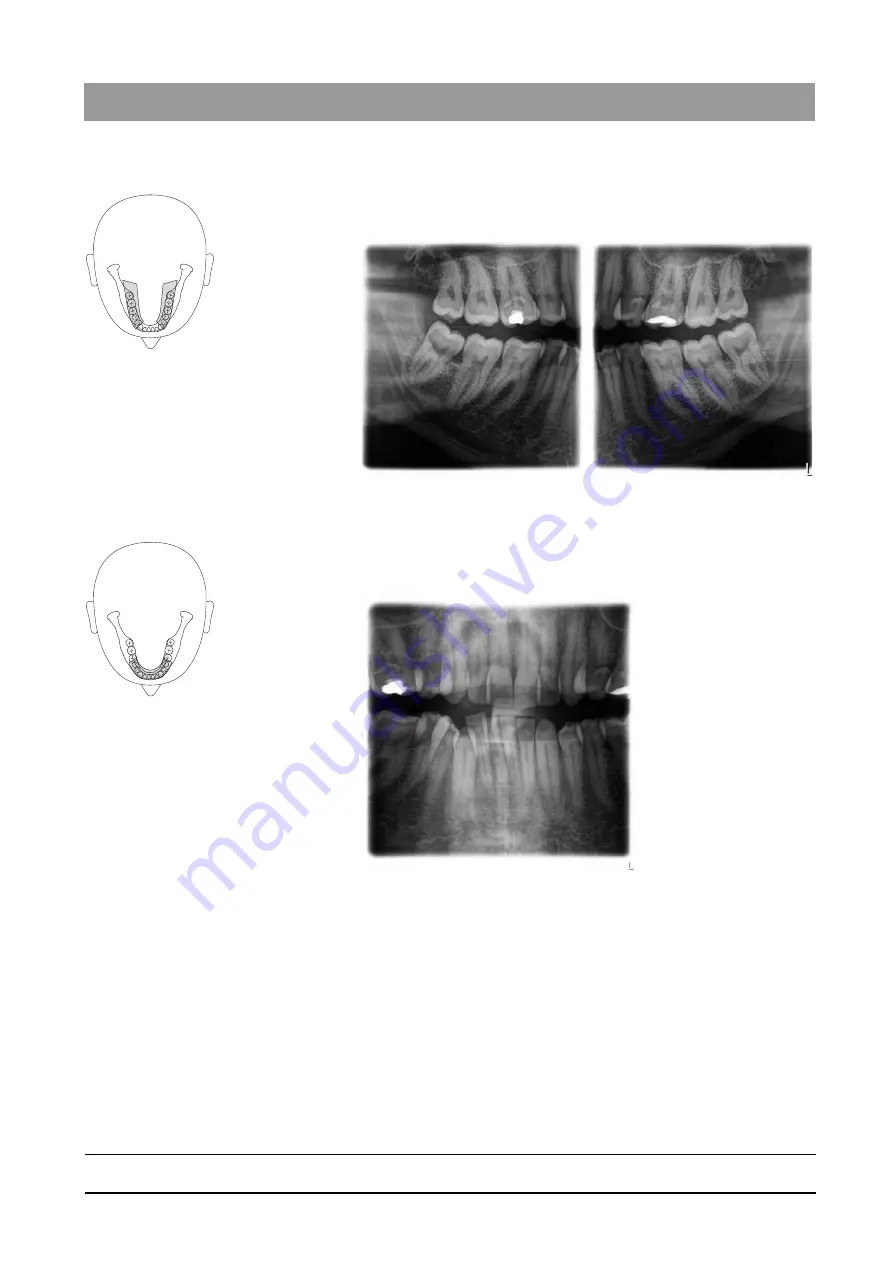 Dentsply Sirona Orthophos SL 2D Operating Instructions Manual Download Page 55