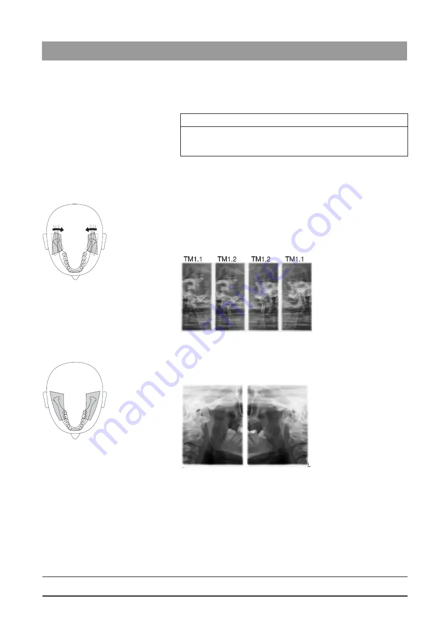 Dentsply Sirona Orthophos SL 2D Operating Instructions Manual Download Page 69