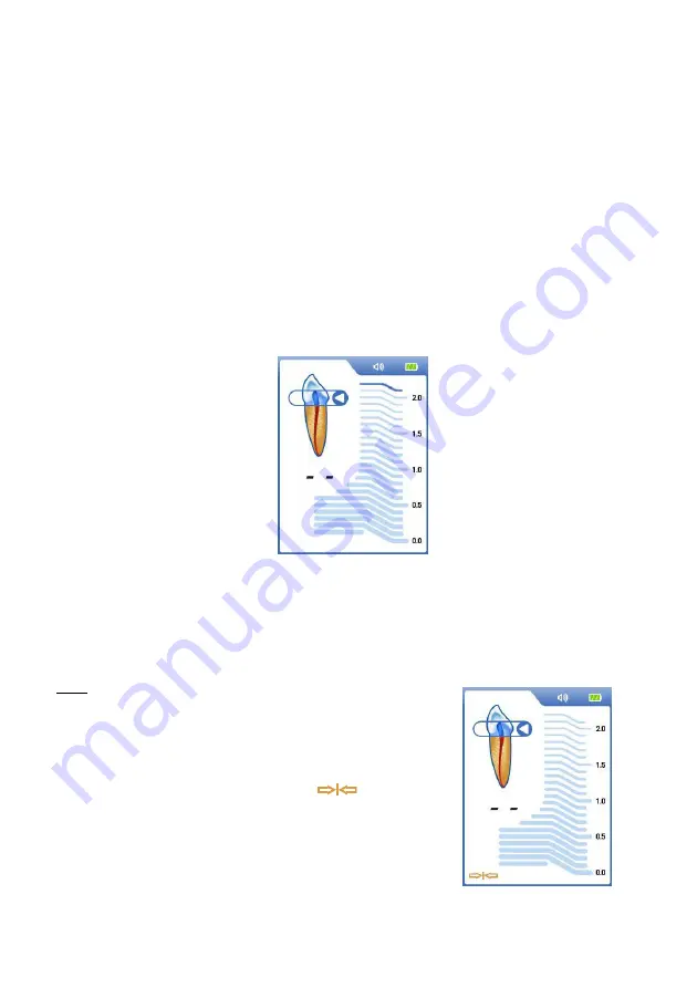 Dentsply Sirona ProPex II Скачать руководство пользователя страница 7