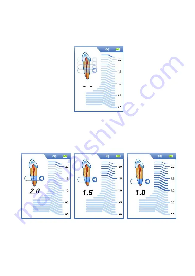 Dentsply Sirona ProPex II Скачать руководство пользователя страница 8