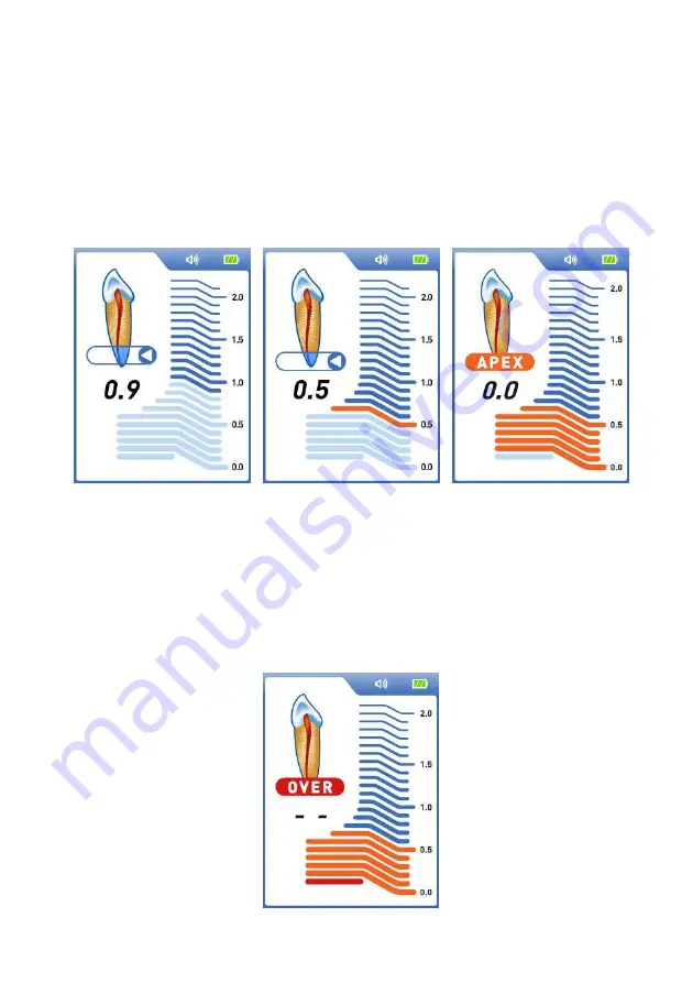 Dentsply Sirona ProPex II Скачать руководство пользователя страница 23