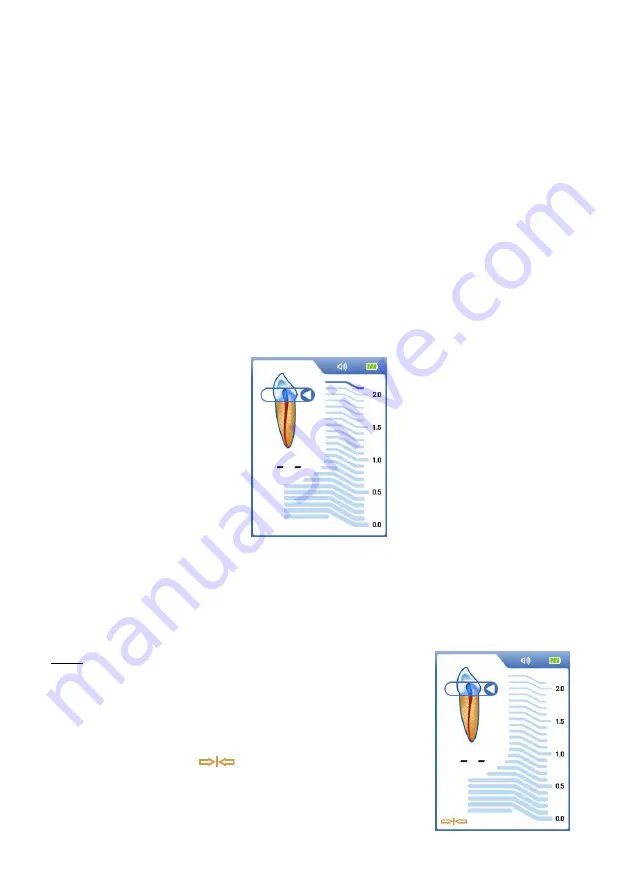 Dentsply Sirona ProPex II Directions For Use Manual Download Page 63