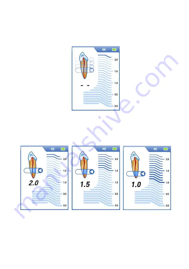 Dentsply Sirona ProPex II Directions For Use Manual Download Page 64