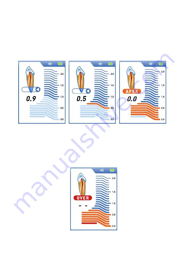 Dentsply Sirona ProPex II Directions For Use Manual Download Page 65