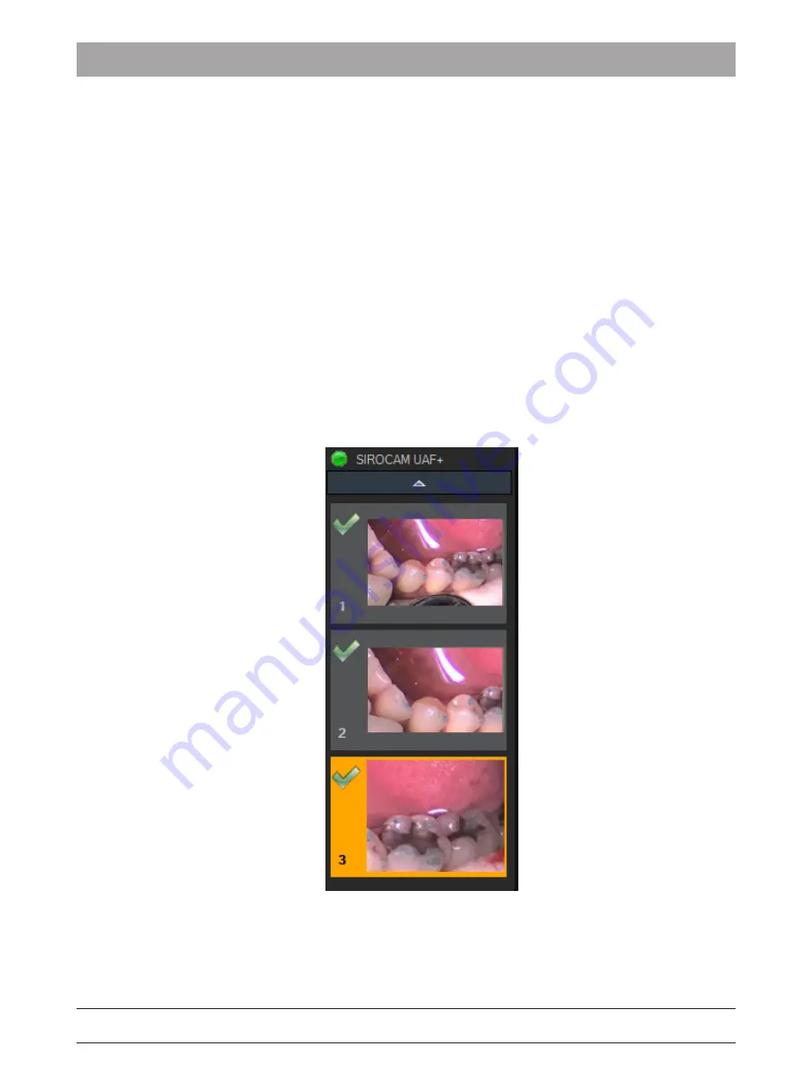 Dentsply Sirona SiroCam AF Instructions For Use Manual Download Page 21