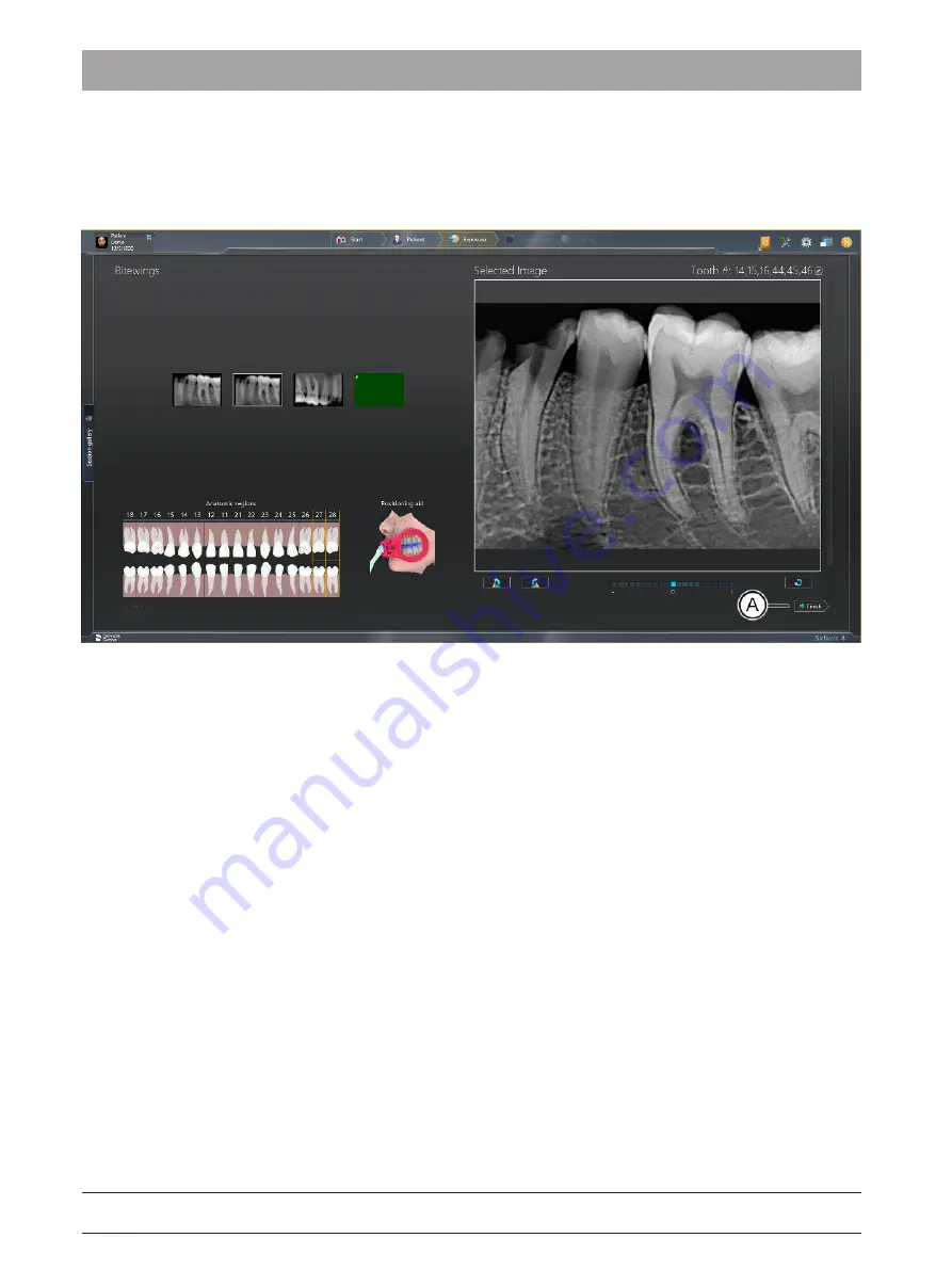 Dentsply Sirona Xios AE Скачать руководство пользователя страница 38