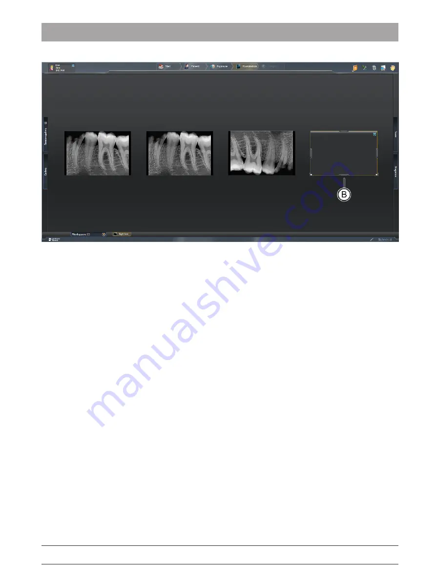 Dentsply Sirona Xios AE Operating Instructions Manual Download Page 39