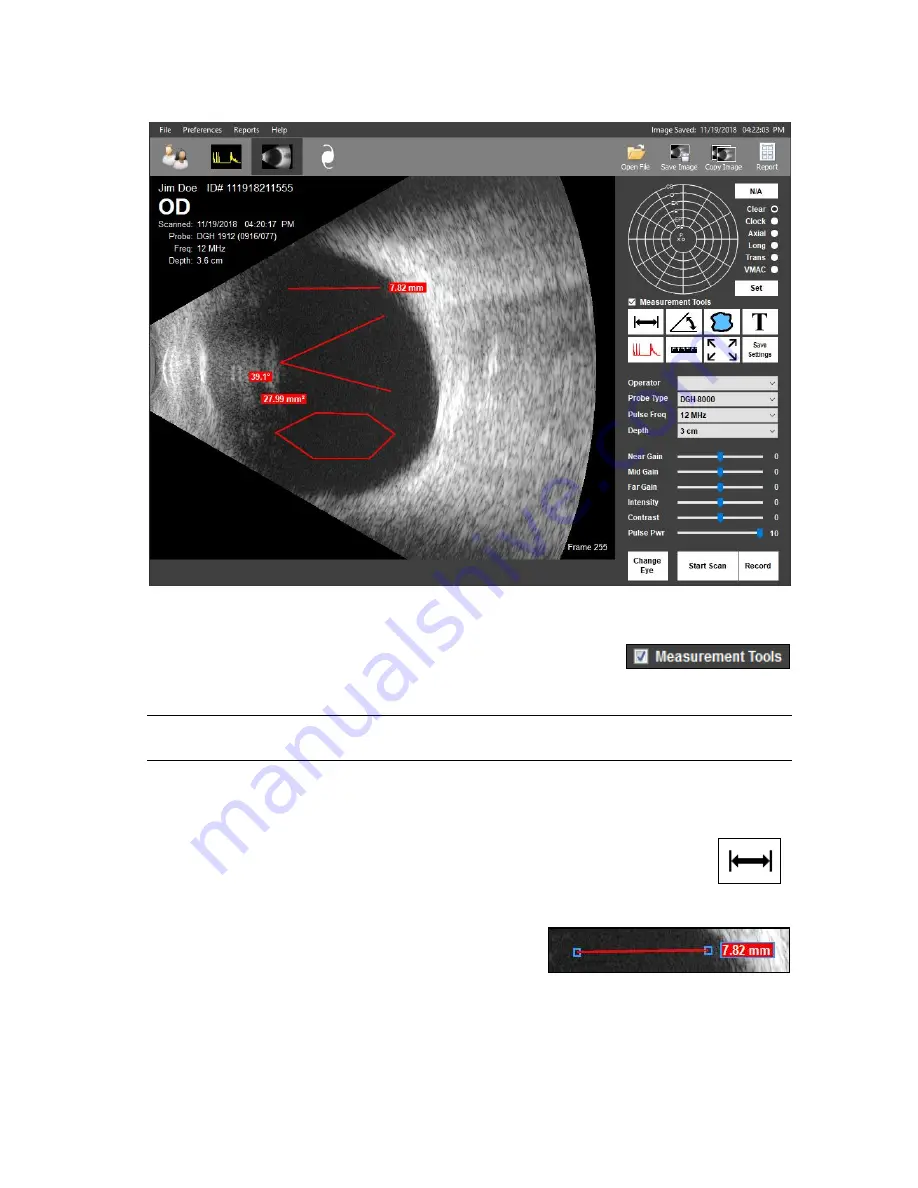 DGH TECHNOLOGY Scanmate-B DGH 8000 Operator'S Manual Download Page 26