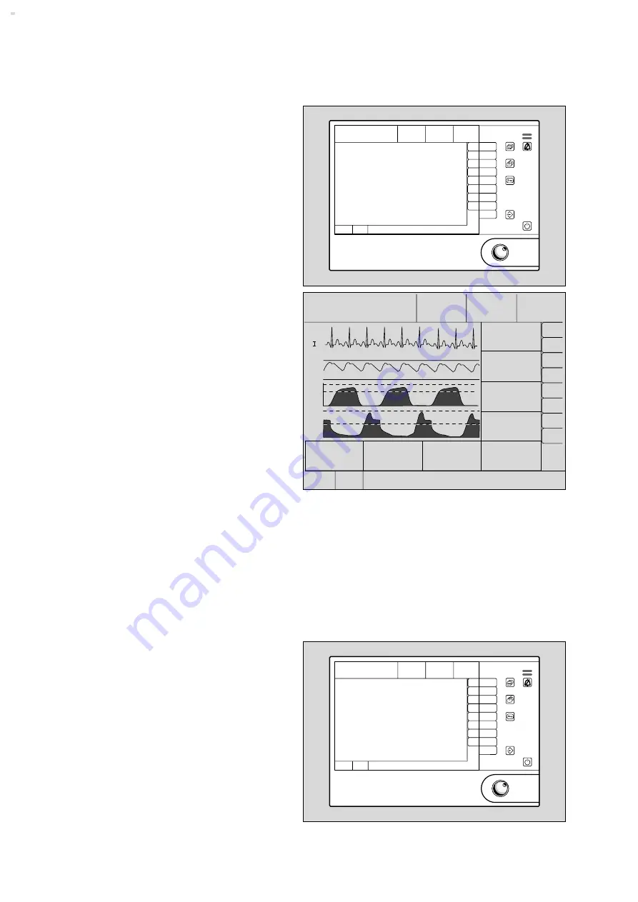 Dräger Cicero EM Instructions For Use Manual Download Page 68