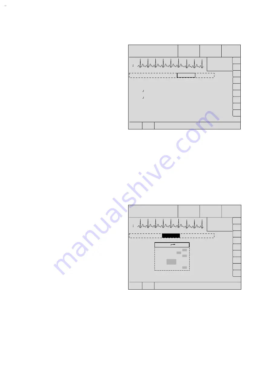 Dräger Cicero EM Instructions For Use Manual Download Page 70