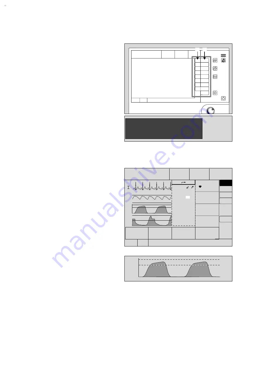 Dräger Cicero EM Instructions For Use Manual Download Page 72