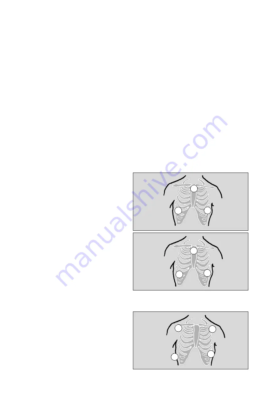 Dräger Cicero EM Instructions For Use Manual Download Page 170