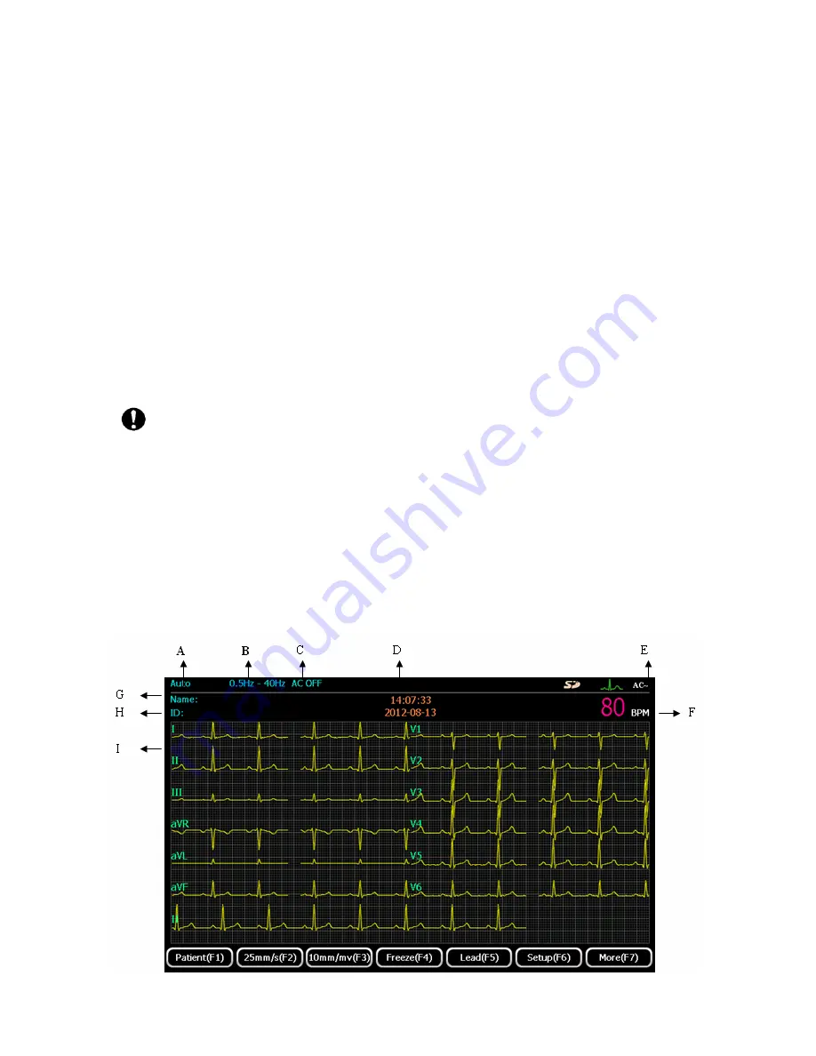 ECGMAC EM-1201 Скачать руководство пользователя страница 28