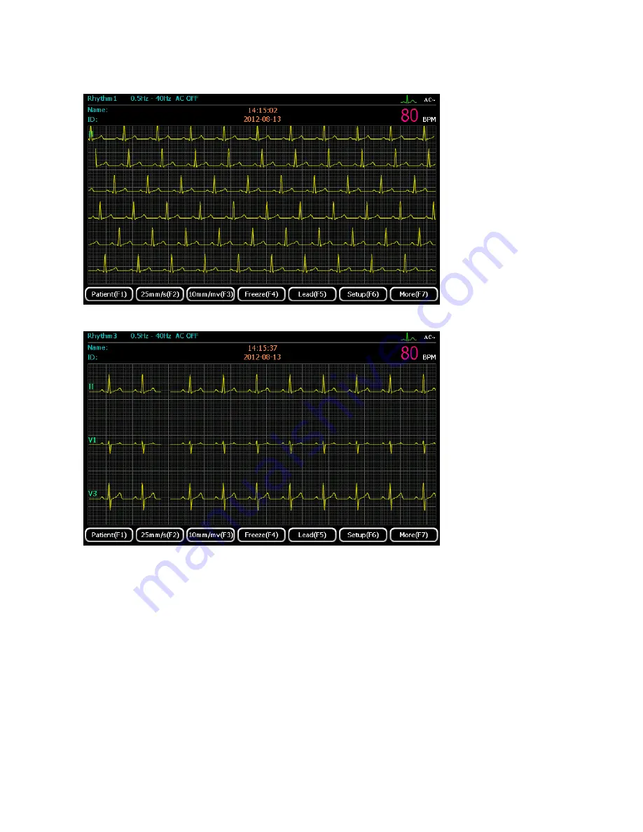 ECGMAC EM-1201 Manual Download Page 37